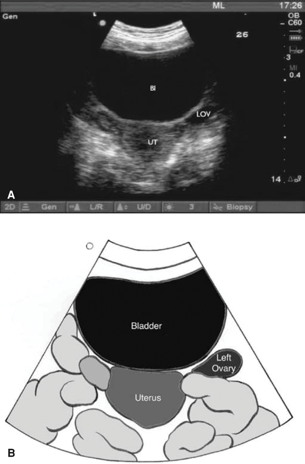 Abdominal and Pelvic